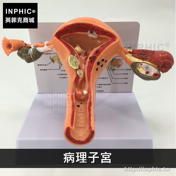 INPHIC-醫學模型醫療實驗道具人體子宮解剖模型生教育演示器材婦產教學