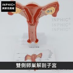 INPHIC-醫療實驗道具女性生殖系統醫學模型婦產教學模型人體子宮解剖模型生教育演示器材-雙側卵巢解剖子宮