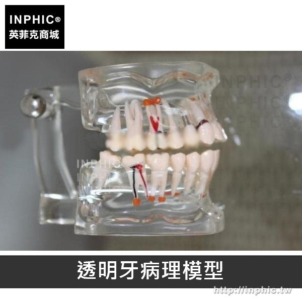 INPHIC-牙醫牙科演示構造牙齒口腔保健醫學模型牙齒模型刷牙教學-透明牙病理模型