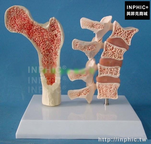 INPHIC-醫學模型醫療實驗道具醫學模型健康與動態骨質比較模型骨骼疏鬆脊椎骨架