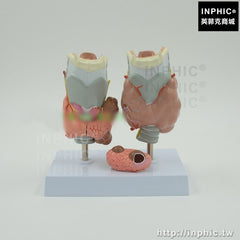 INPHIC-醫學模型甲狀腺病醫療實驗道具甲亢甲低甲減甲狀腺病理模型腫瘤模型